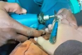 Cincin sulit lepas dari jari, petugas Damkar bisa bantu