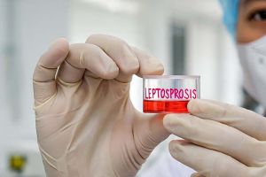 Per 4 Juli 2025, ada 859 kasus suspek leptospirosis di Jateng