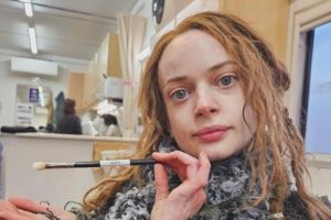 Pemeran film "How To Train Your Dragon" Ruth Codd jalani amputasi kaki