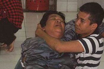 Keluarga Korban Ledakan Tabung Gas Karbit di Karimun