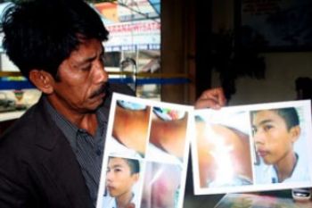 Foto Siswa SMPN 2 Buru Yang Diduga Dianiaya Oknum Guru