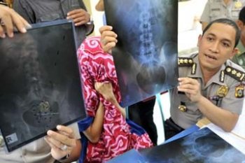 PENYELUNDUPAN HASHIS DALAM PERUT