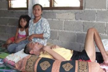 Empat Tahun Terbaring Bersama Tumor di Kepala            