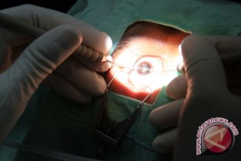 RSA UGM gelar operasi katarak gratis 