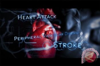 Pakar: Stroke Juga Bisa Menimpa Anak
