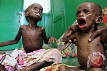 215 Ribu Anak Somalia Butuh Perawatan Kesehatan     