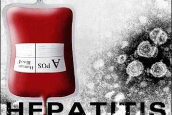 Puluhan Murid SD di Padang Terserang Hepatitis