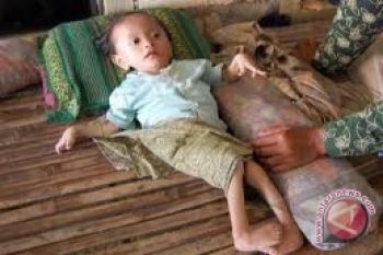 Pakar: cegah "stunting" sejak anak dalam kandungan