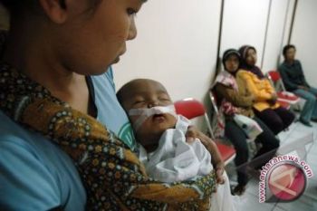 Kodim 0406 Lubuklinggau gelar operasi bibir sumbing