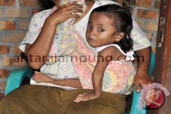 Kasihan, Nisa 5 Tahun Belum Normal