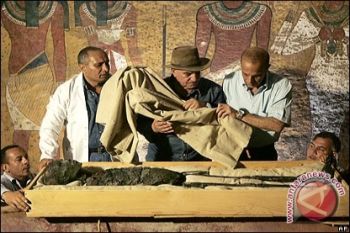  Mumi Raja Tutankhamun Pernah Terbakar