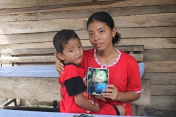 Penderita Tumor Syaraf di Agam Butuh Bantuan