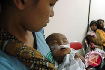 Puluhan Penderita Bibir Sumbing Dibantu Operasi Gratis 