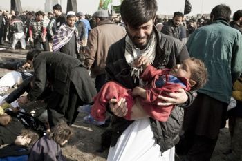 Militan Taliban dan Tentara Afghanistan dirawat bersama