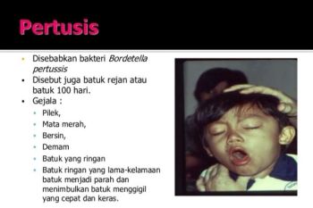 Kementerian Kesehatan kirim Tim Pemulihan Pertusis Nduga 