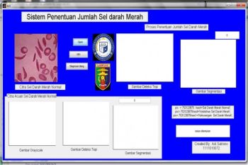 Mahasiswa Darmajaya ciptakan pendeteksi jumlah sel darah