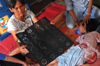 Aisyah, bocah tujuh tahun penderita lumpuh harapkan bantuan