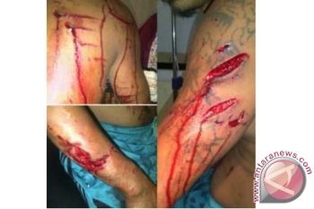 Seorang warga Jailolo diserang buaya