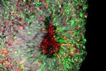 Harapan baru Penanganan Zika dari Obat yang Sudah ada 