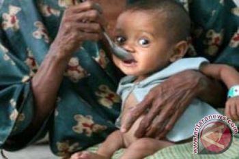Empat Balita Terdeteksi Gizi Buruk