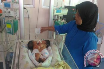 RSUP M. Djamil Bentuk Tim Tangani Bayi Kembar Siam