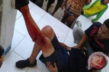 Singaporean Tourist Bitten By Komodo Dragon