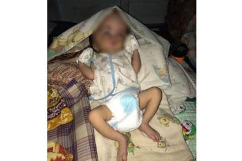 KNPI Barito Utara Galang Dana untuk Bayi Hidrosefalus 