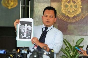  Kemkes Anjurkan Masyarakat Deteksi Dini Kanker Serviks