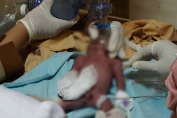 Temuan Bayi di Toilet Citimall Diduga Kesengajaan Pelaku