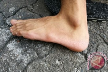 Kenali kondisi kesehatan dari tanda di kaki Anda - ANTARA News
