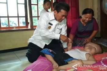 Pemkab Tanggung Biaya Pengobatan Penderita Hydrocephalus