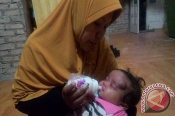 Bayi Pengidap Tumor Pembuluh Darah Pasaman Butuh Uluran Tangan