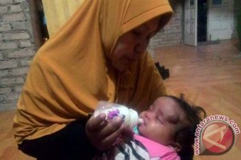 Bayi Pengidap Tumor Pembuluh Darah Asal Pasaman Menjalani Operasi
