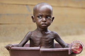450.000 Anak Terancam Kekurangan Gizi Akut di Nigeria