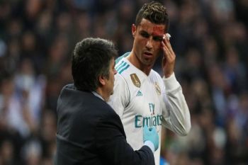  Ronaldo tetap "tampan" setelah wajahnya terluka