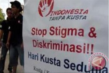 Masyarakat jangan diskriminatif terhadap eks penderita kusta