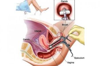 Wanita diharapkan cegah kanker payudara dan rahim sejak dini