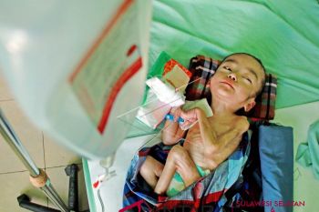 Dinkes Sulbar sosialisasi orentasi asuhan gizi terstandar
