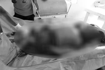 Identitas mayat wanita membusuk di Bartim masih misterius