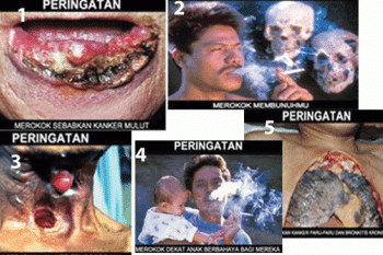 Setelah bergambar, bungkus rokok bakal polos