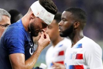 Giroud tinggalkan lapangan dengan dahi berlumur darah