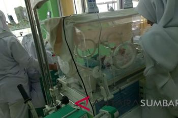 Bayi kembar siam di Pasaman dirujuk ke RSUP M Djamil