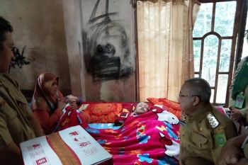 Bupati Bantul kunjungi warga Dlingo penderita hidrosefalus