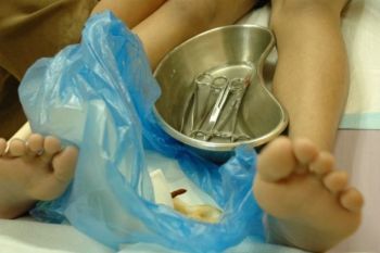 Sunat perempuan masuk dalam kategori kekerasan terhadap anak