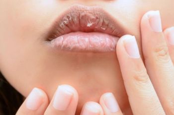 Cara alami atasi bibir kering dan pecah-pecah agar tampil percaya diri