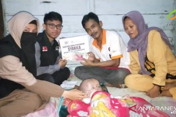 ACT Sumsel bantu pengobatan bayi penderita penyakit hidrosefalus