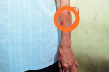 Seorang nenek disambar buaya saat mandi