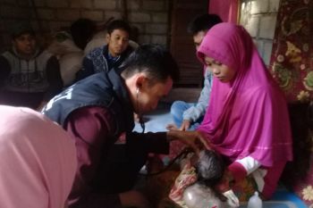ACT NTB membantu pengobatan bayi menderita meningensofalokel