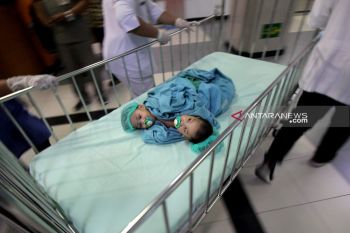 Kembar siam Aqila &amp; Azila jalani operasi pemisahan