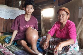 Memet, penderita kanker tulang di Palangka Raya butuh bantuan dermawan